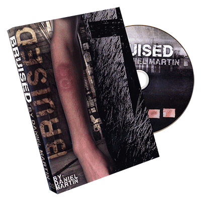 Bruised by Daniel Martin - Trick