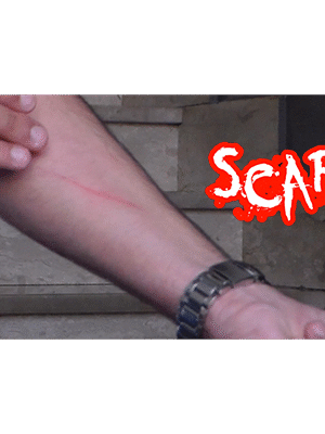 SCAR by Dan Alex - Video DOWNLOAD