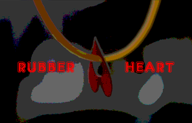 Rubber Heart by Arnel Renegado video DOWNLOAD